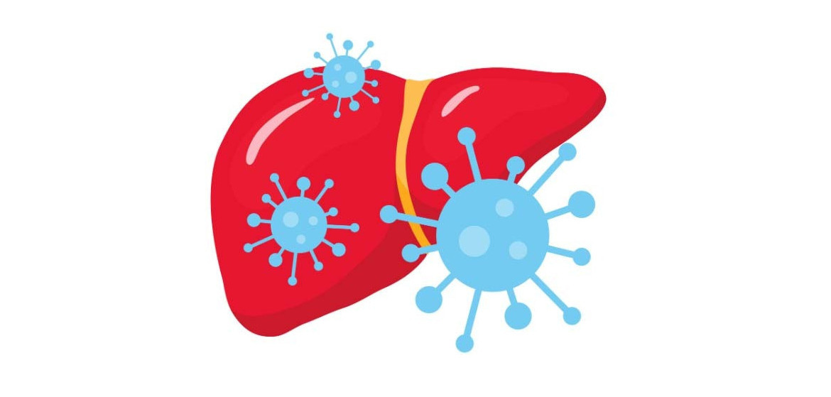 Metabolic Risk Persists Even After Hepatitis C is Cured - Cancer Health 4 164090 HCV liver iStock.jpg 58acebf8 9f6d 4e63 a374