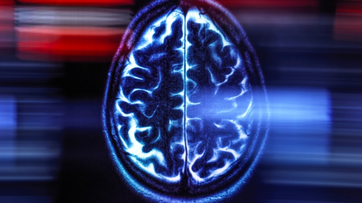 Theres One Critical Thing You Can Do to Cut Your Risk of Dementia 1 brain image dementia header