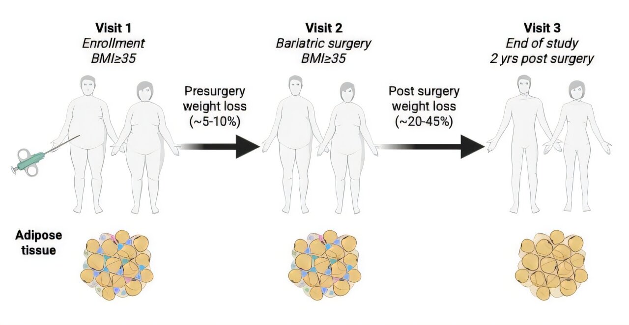 How weight loss benefits the health of your fat tissue - Medical Xpress 1 new study how weight l 1
